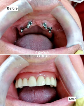 Slider image (2) DENTOCLINIC